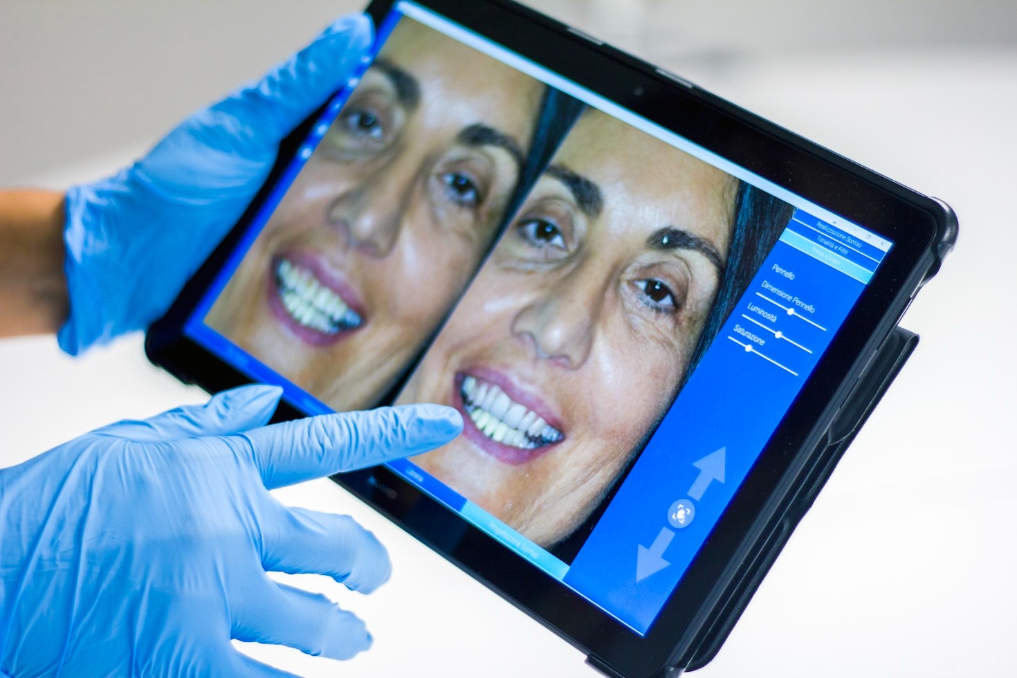 Guida pratica per mantenere i denti sani